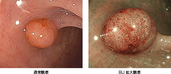 通常観察・BLI拡大観察
